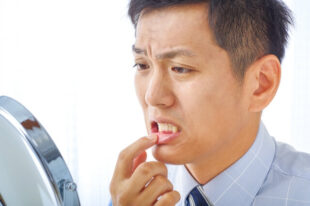 歯茎が気になる